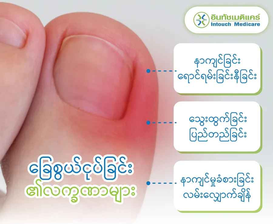 Symptoms of ingrown toenails