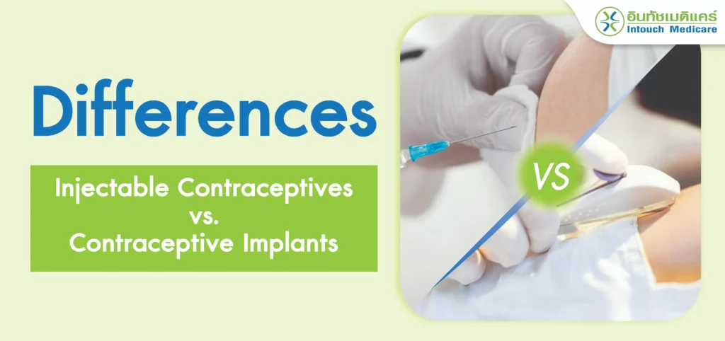 The Difference Between Injectable Contraceptives and Contraceptive Implants