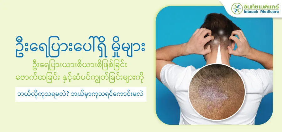 ဦးရေပြားပေါ်မှ မှိုများ ဦးရေပြားယားယံခြင်းနှင့် ဗောက်များကို ဘယ်လိုကုသမလဲ။