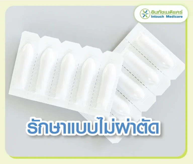 Non-surgical-treatment รักษาแบบไม่ผ่าตัด
