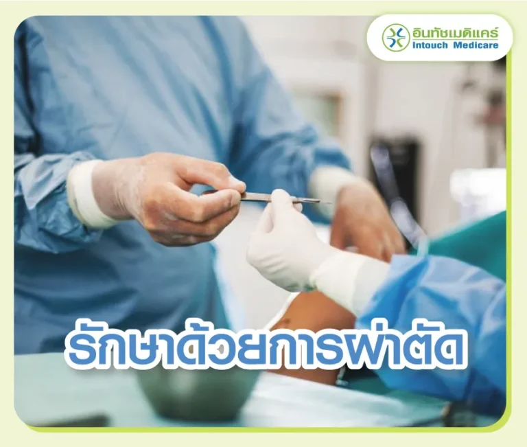 Treated-with-surgery รักษาด้วยการผ่าตัด